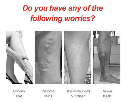 Varicose Veins Patch