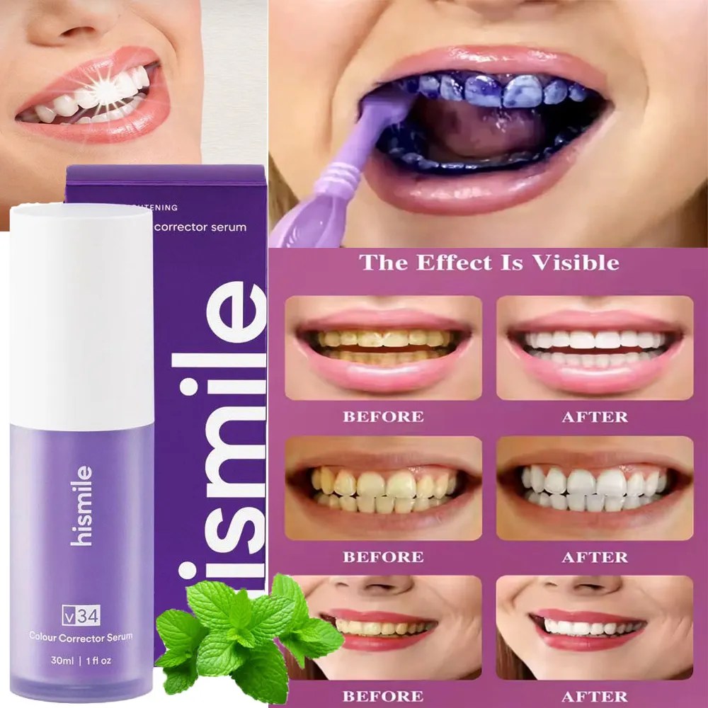 Hismile V34 Purple Colour Corrector Serum (30ml) | Teeth Brightening & Colour Correcting Whitening Serum