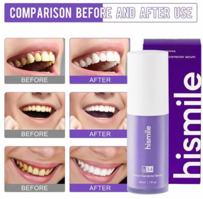 Hismile V34 Purple Colour Corrector Serum (30ml) | Teeth Brightening & Colour Correcting Whitening Serum