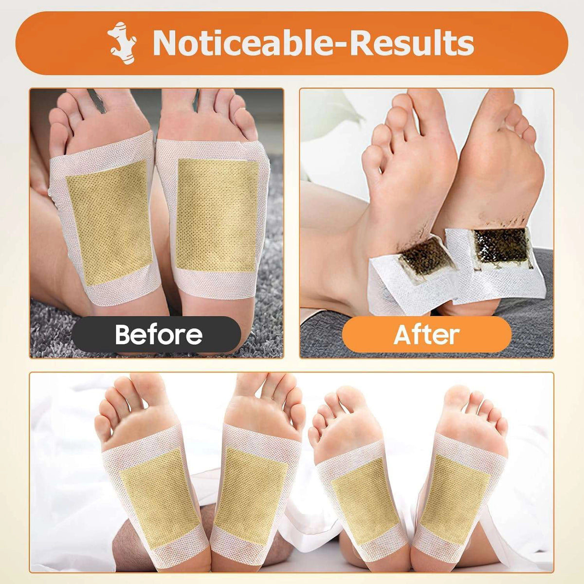 Kinoki Ginger Foot Pads (10 Pcs) | Herbal Overnight Foot Care Patches with Ginger | Relaxation & Comfort