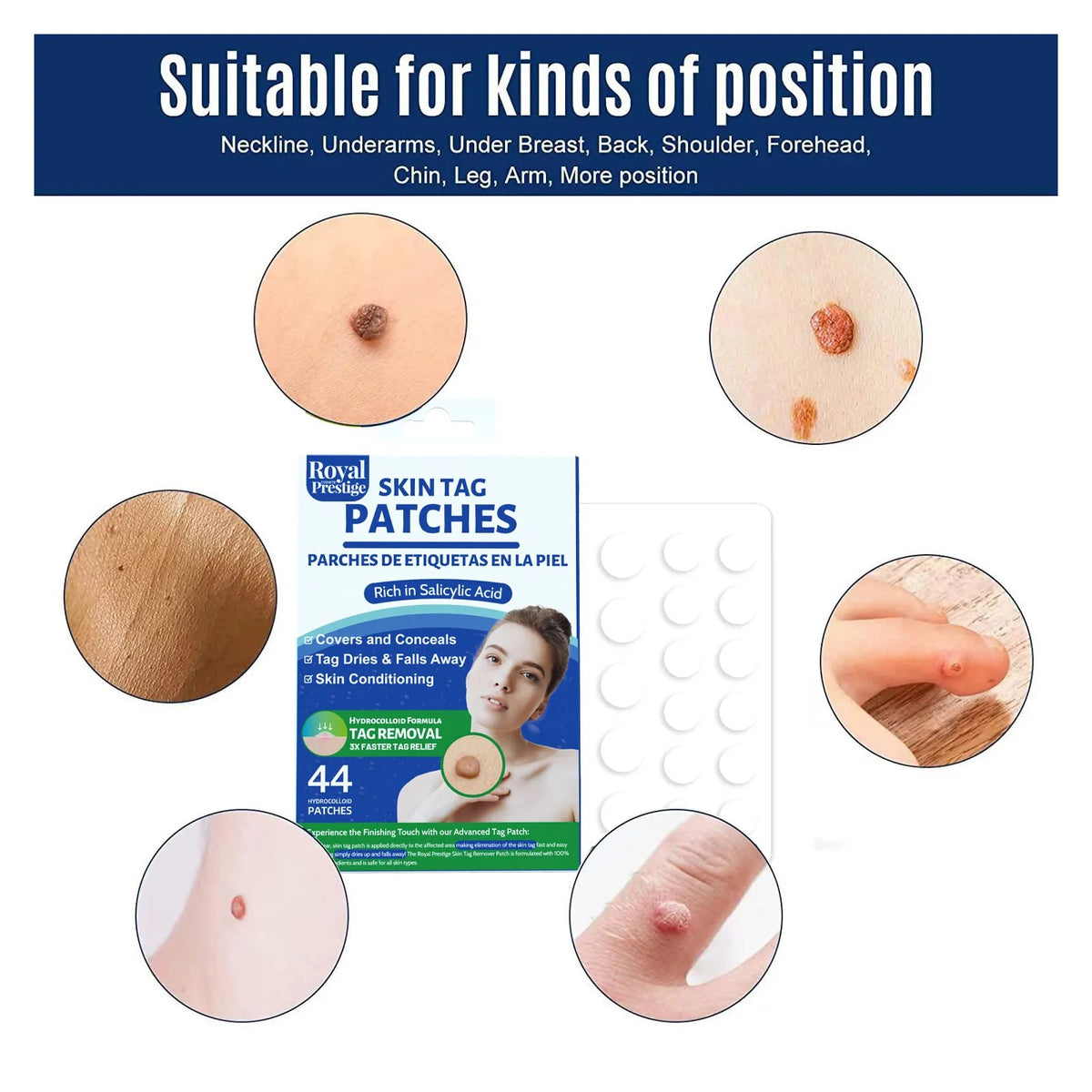 Skin Tag Remover Patches 44 PCs by Royal Prestige
