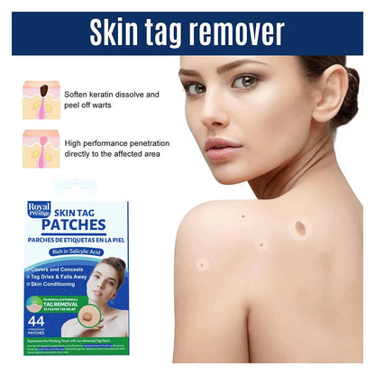 Skin Tag Remover Patches 44 PCs by Royal Prestige