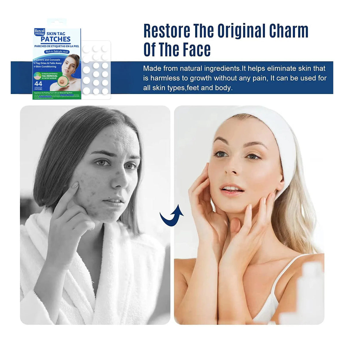 Skin Tag Remover Patches 44 PCs by Royal Prestige