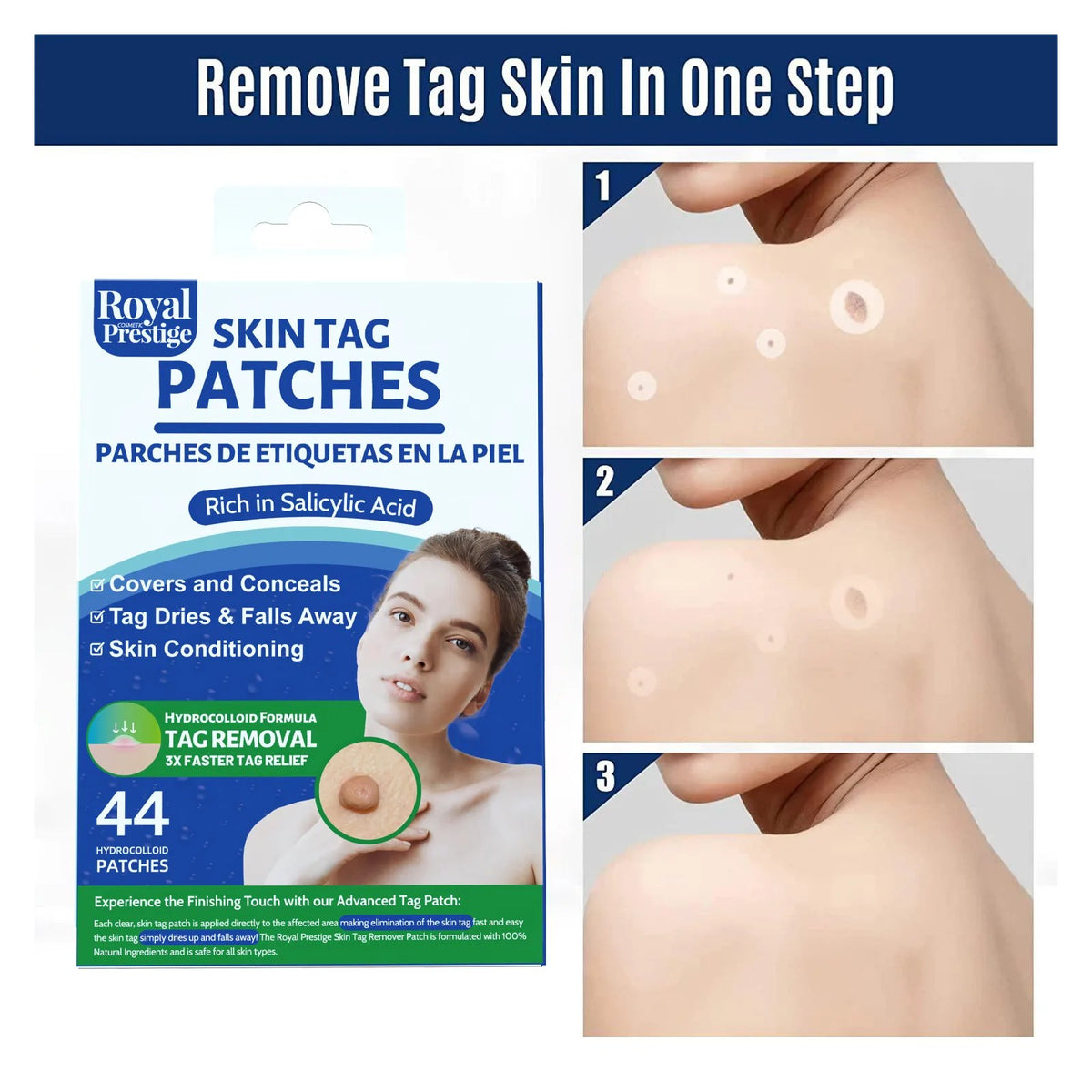 Skin Tag Remover Patches 44 PCs by Royal Prestige