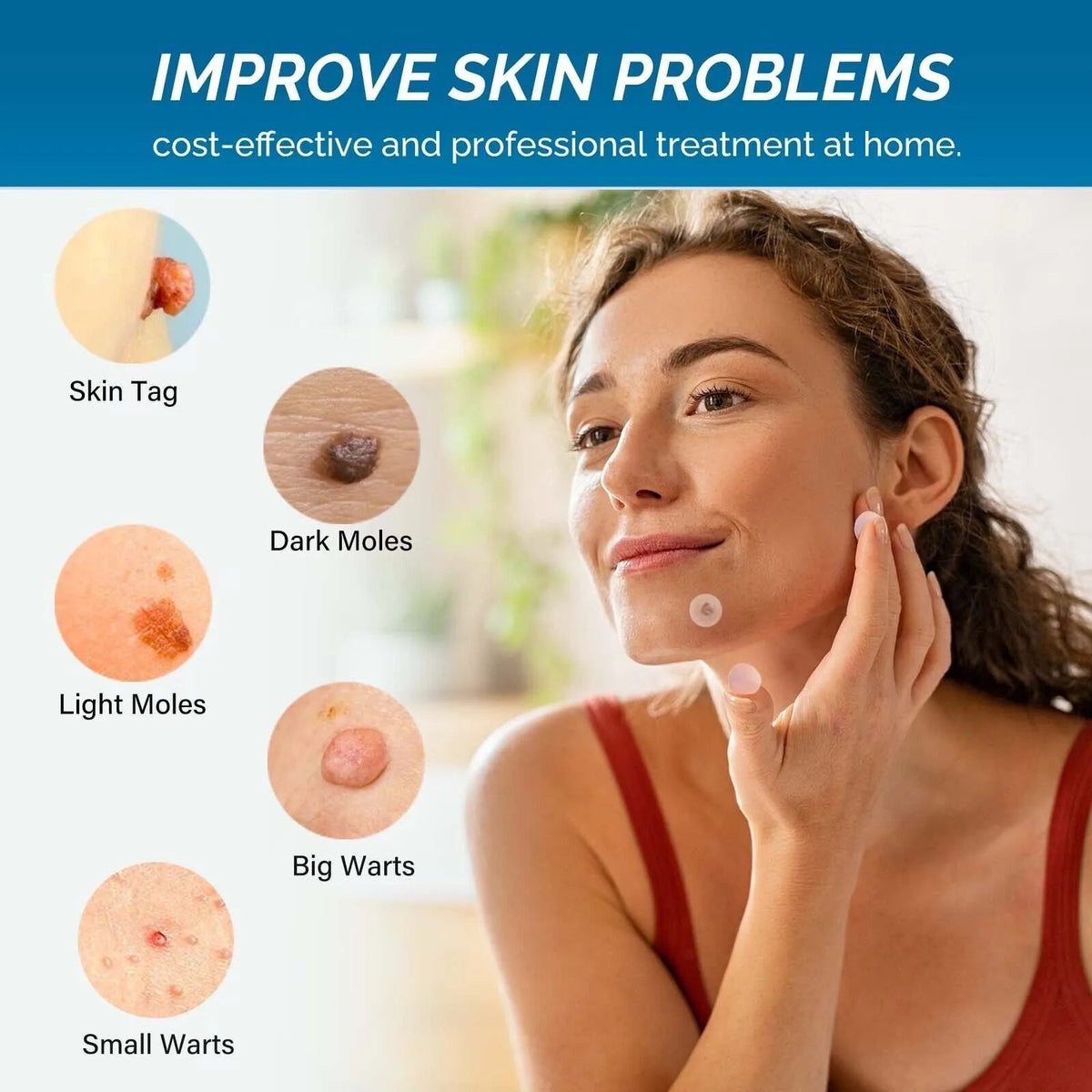 Skin Tag Remover Patches, 66 Patches by Royal Prestige