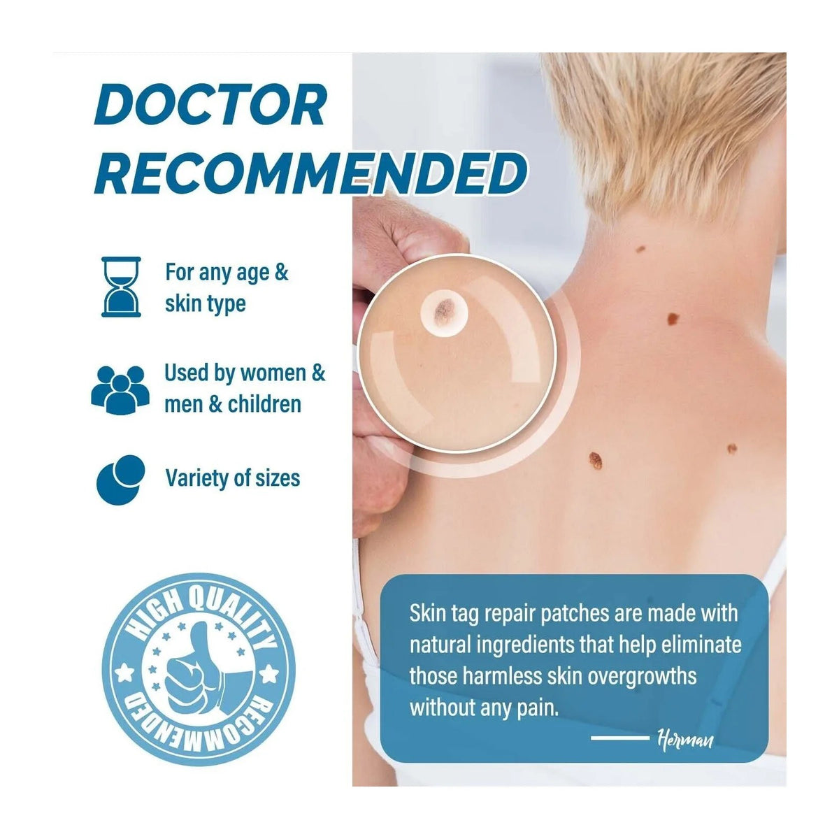 Skin Tag Remover Patches, 66 Patches by Royal Prestige