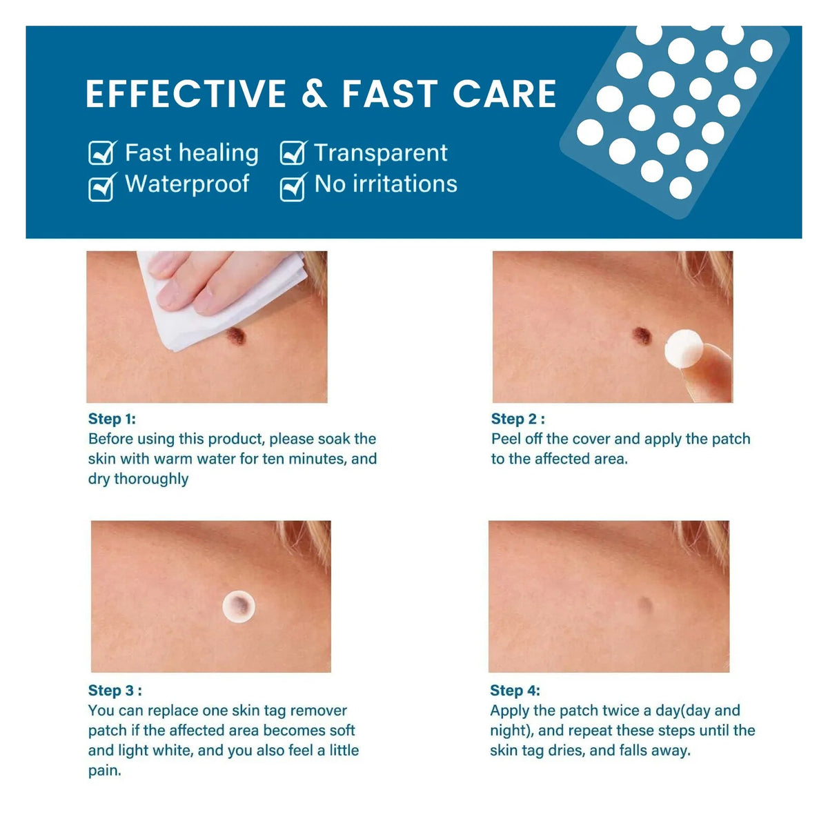 Skin Tag Remover Patches, 66 Patches by Royal Prestige