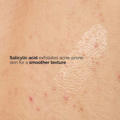 The Ordinary Salicylic Acid 0.5% Body Serum