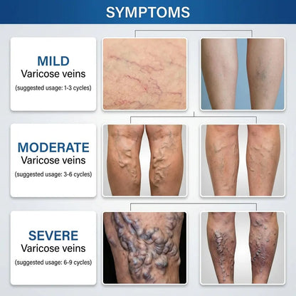 Varicose Vein Care Patch (8 Boxes) – Herbal Leg Support Patch for Circulation & Vein Comfort