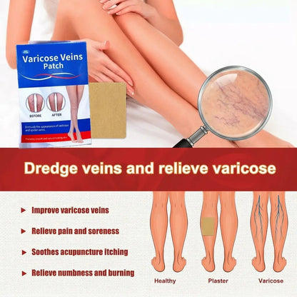 Varicose Vein Care Patch (8 Boxes) – Herbal Leg Support Patch for Circulation & Vein Comfort